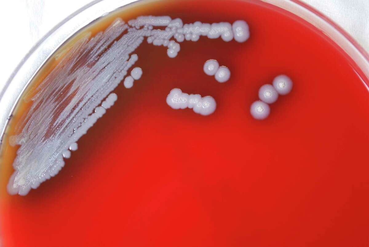 Emiten alerta por la detección de bacterias de una rara enfermedad en Estados Unidos